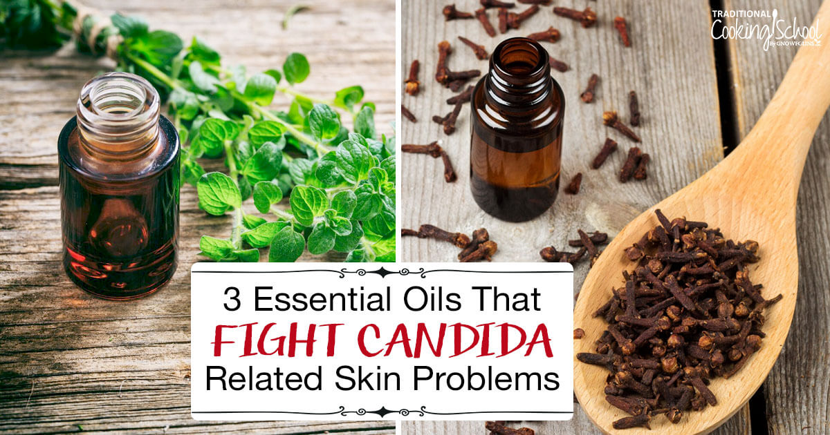 3-essential-oils-that-fight-candida-related-skin-problems