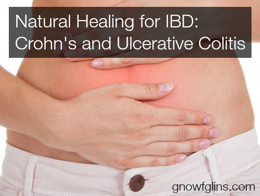 Natural Healing for IBD | Nutritional therapist Lydia Shatney is back! Today, she's helping us understand (and implement) natural healing therapies for Crohn's and ulcerative colitis. Lydia is the teacher and creator of the online class Heal Your Gut. If you have questions or comments for Lydia, be sure to share in the comments. | TraditionalCookingSchool.com