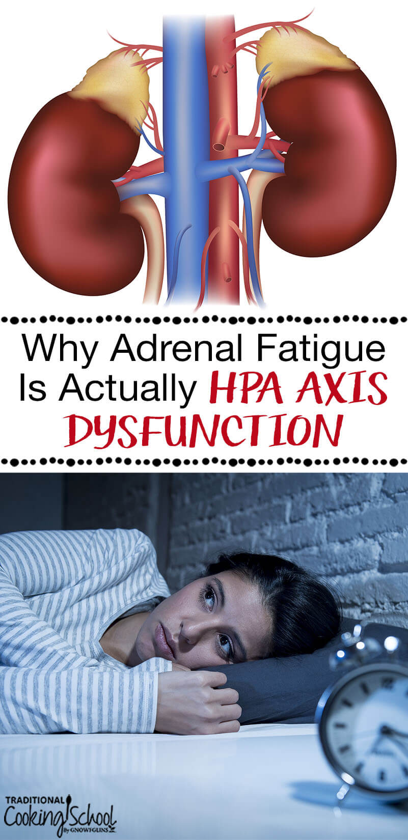 The hypothalamus-pituitary-adrenal loop produces hormones that regulate our blood pressure, libido, metabolism, and stress response. When interference happens, symptoms of a hormone imbalance occur: insomnia, fatigue, anxiety/depression, thyroid issues, and more. This used to be called 'adrenal fatigue', but was that accurate? Learn why adrenal fatigue is actually HPA axis dysfunction.