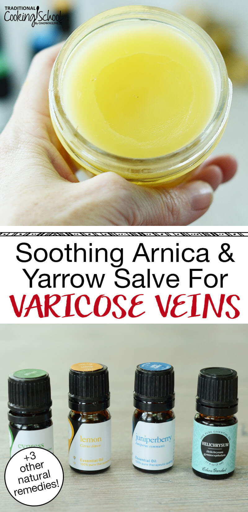 photo collage of a yellow-colored salve in a half pint Mason jar and four essential oils including juniper berry and helichrysum, with text overlay: "Soothing Arnica & Yarrow Salve For Varicose Veins (+3 other natural remedies!)"