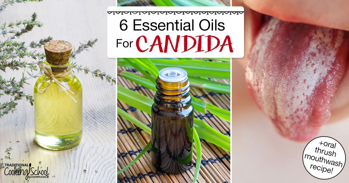 Essential Oils for Yeast Infection - Candida - Thrush - Essential 3