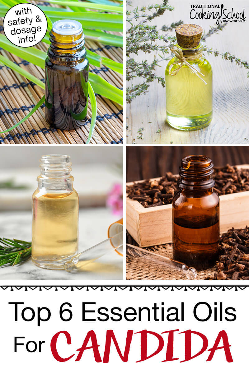 Photo collage of various small bottles of essential oils. Text overlay says: "Top 6 Essential Oils For Candida (with safety & dosage info!)"