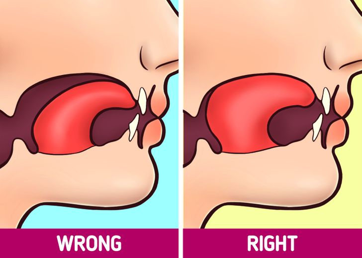 roper tongue posture with the tongue resting against the roof of the mouth... the foundation of airway health in myofunctional therapy.